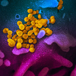Novel Coronavirus SARS-CoV-2, Image Credit: NIAID-RML